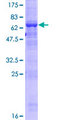 ACTL9 Protein - 12.5% SDS-PAGE of human MGC33407 stained with Coomassie Blue