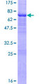 ACTR10 Protein - 12.5% SDS-PAGE of human ACTR10 stained with Coomassie Blue