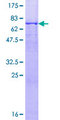 ACTR1B Protein - 12.5% SDS-PAGE of human ACTR1B stained with Coomassie Blue