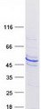 ACTR1B Protein - Purified recombinant protein ACTR1B was analyzed by SDS-PAGE gel and Coomassie Blue Staining