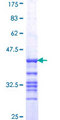 ACTRT2 Protein - 12.5% SDS-PAGE Stained with Coomassie Blue.