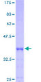 ACYP1 Protein - 12.5% SDS-PAGE of human ACYP1 stained with Coomassie Blue