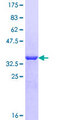ACYP2 Protein - 12.5% SDS-PAGE of human ACYP2 stained with Coomassie Blue