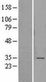 ADAL Protein - Western validation with an anti-DDK antibody * L: Control HEK293 lysate R: Over-expression lysate
