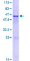 ADAL Protein - 12.5% SDS-PAGE of human ADAL stained with Coomassie Blue