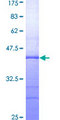 ADAR2 / ADARB1 Protein - 12.5% SDS-PAGE Stained with Coomassie Blue.