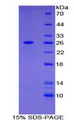 ADCY6 / Adenylate Cyclase 6 Protein - Recombinant Adenylate Cyclase 6 By SDS-PAGE