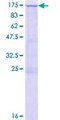 ADD2 Protein - 12.5% SDS-PAGE of human ADD2 stained with Coomassie Blue