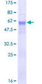 ADH6 Protein - 12.5% SDS-PAGE of human ADH6 stained with Coomassie Blue
