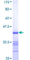 ADHFE1 Protein - 12.5% SDS-PAGE Stained with Coomassie Blue.