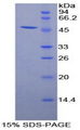 ADIPOR1/Adiponectin Receptor 1 Protein - Recombinant Adiponectin Receptor 1 By SDS-PAGE