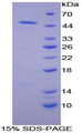 ADIPOR2 Protein - Recombinant Adiponectin Receptor 2 By SDS-PAGE