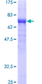 ADSS Protein - 12.5% SDS-PAGE of human ADSS stained with Coomassie Blue