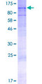 AGBL5 Protein - 12.5% SDS-PAGE of human AGBL5 stained with Coomassie Blue