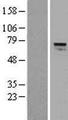 AGPS Protein - Western validation with an anti-DDK antibody * L: Control HEK293 lysate R: Over-expression lysate