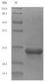 AGTR2 / AT2 Receptor Protein - (Tris-Glycine gel) Discontinuous SDS-PAGE (reduced) with 5% enrichment gel and 15% separation gel.