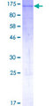 AHR Protein - 12.5% SDS-PAGE of human AHR stained with Coomassie Blue