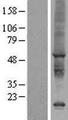 AIG1 Protein - Western validation with an anti-DDK antibody * L: Control HEK293 lysate R: Over-expression lysate