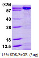 AK5 / Adenylate Kinase 5 Protein