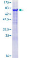 AK8 Protein - 12.5% SDS-PAGE of human C9orf98 stained with Coomassie Blue