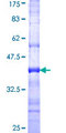 AKAP1 / AKAP Protein - 12.5% SDS-PAGE Stained with Coomassie Blue.