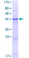 AKAP14 Protein - 12.5% SDS-PAGE of human AKAP14 stained with Coomassie Blue