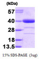 AKR1A1 Protein