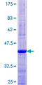 AKR1C8P / AKR1CL1 Protein