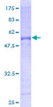AKTIP / FTS Protein - 12.5% SDS-PAGE of human FTS stained with Coomassie Blue