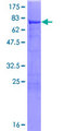 ALDH7A1 Protein - 12.5% SDS-PAGE of human ALDH7A1 stained with Coomassie Blue