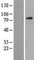 ALDP / ABCD1 Protein - Western validation with an anti-DDK antibody * L: Control HEK293 lysate R: Over-expression lysate