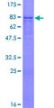 ALG1 Protein - 12.5% SDS-PAGE of human ALG1 stained with Coomassie Blue