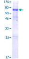 ALKBH5 Protein - 12.5% SDS-PAGE of human ALKBH5 stained with Coomassie Blue