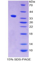 ALPPL2 Protein - Recombinant Alkaline Phosphatase, Placental Like Protein 2 By SDS-PAGE