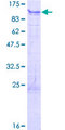 ALS2CR11 Protein - 12.5% SDS-PAGE of human ALS2CR11 stained with Coomassie Blue