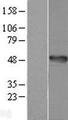 AMDHD1 Protein - Western validation with an anti-DDK antibody * L: Control HEK293 lysate R: Over-expression lysate