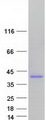 AMMECR1 Protein - Purified recombinant protein AMMECR1 was analyzed by SDS-PAGE gel and Coomassie Blue Staining