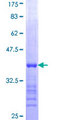 AMPD3 Protein - 12.5% SDS-PAGE Stained with Coomassie Blue.