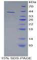 AMY1A / Salivary Amylase Protein - Recombinant Amylase Alpha 1, Salivary By SDS-PAGE