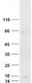 AMY1B Protein - Purified recombinant protein AMY1B was analyzed by SDS-PAGE gel and Coomassie Blue Staining