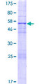 ANGEL2 Protein - 12.5% SDS-PAGE of human ANGEL2 stained with Coomassie Blue