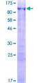 ANKMY1 Protein - 12.5% SDS-PAGE of human ANKMY1 stained with Coomassie Blue