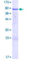 ANKMY2 Protein - 12.5% SDS-PAGE of human ANKMY2 stained with Coomassie Blue