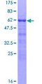 ANKRA2 / ANKRA Protein - 12.5% SDS-PAGE of human ANKRA2 stained with Coomassie Blue