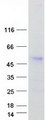 ANKRD10 Protein - Purified recombinant protein ANKRD10 was analyzed by SDS-PAGE gel and Coomassie Blue Staining