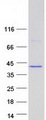 ANKRD16 Protein - Purified recombinant protein ANKRD16 was analyzed by SDS-PAGE gel and Coomassie Blue Staining