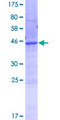 ANKRD22 Protein - 12.5% SDS-PAGE of human ANKRD22 stained with Coomassie Blue