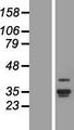 ANKRD29 Protein - Western validation with an anti-DDK antibody * L: Control HEK293 lysate R: Over-expression lysate