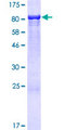 ANKS3 Protein - 12.5% SDS-PAGE of human ANKS3 stained with Coomassie Blue