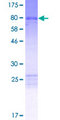 ANKS6 Protein - 12.5% SDS-PAGE of human ANKS6 stained with Coomassie Blue